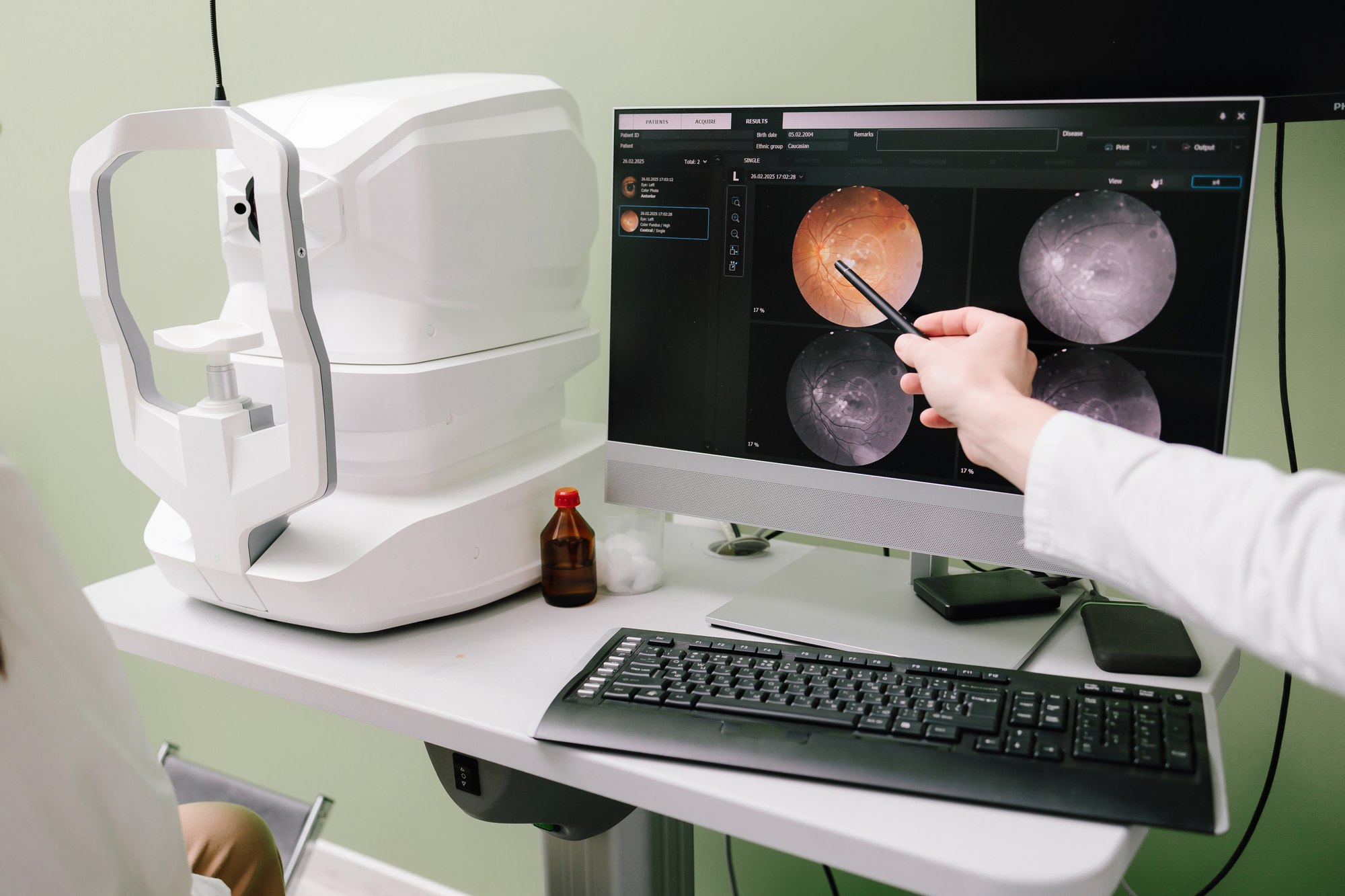 Retinal imaging scan results displayed on a monitor